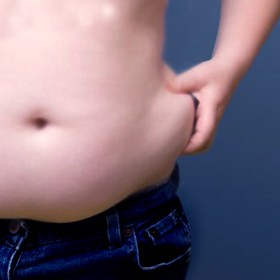 OBESIDAD_-CONCEPTO